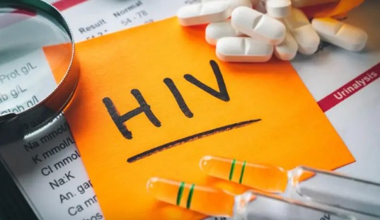 Hiv